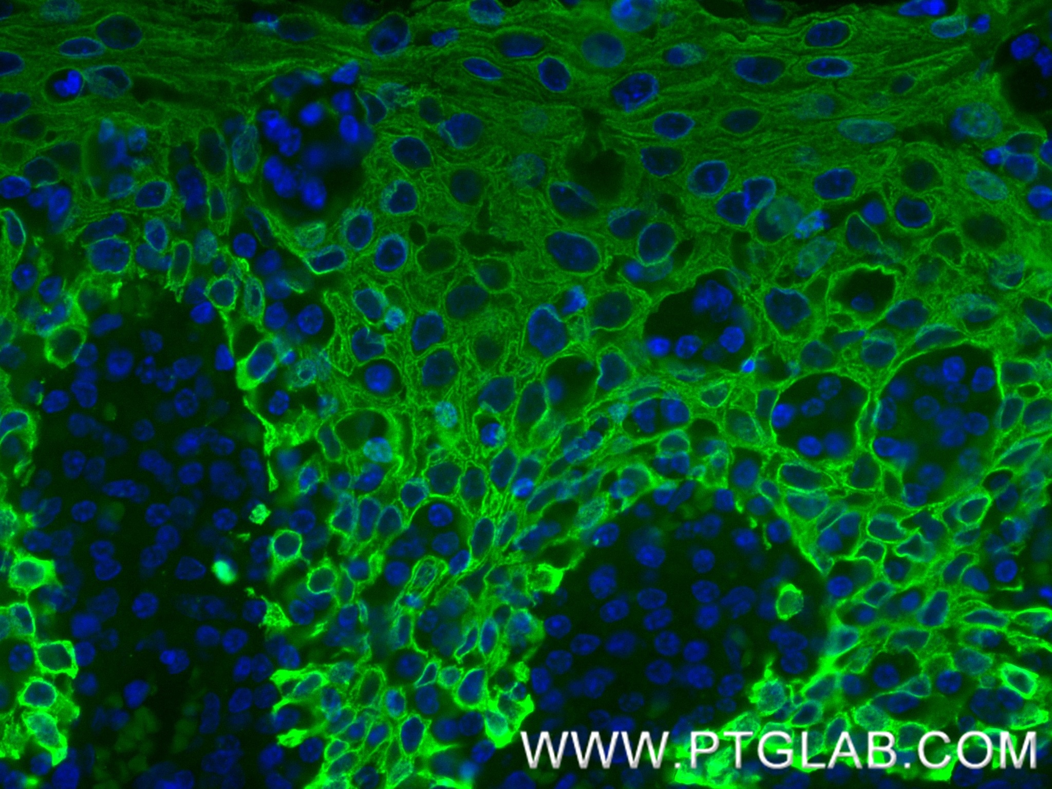 Immunofluorescence (IF) / fluorescent staining of human tonsil tissue using Pan-Keratin (Type I) Recombinant monoclonal antibo (86238-5-RR)
