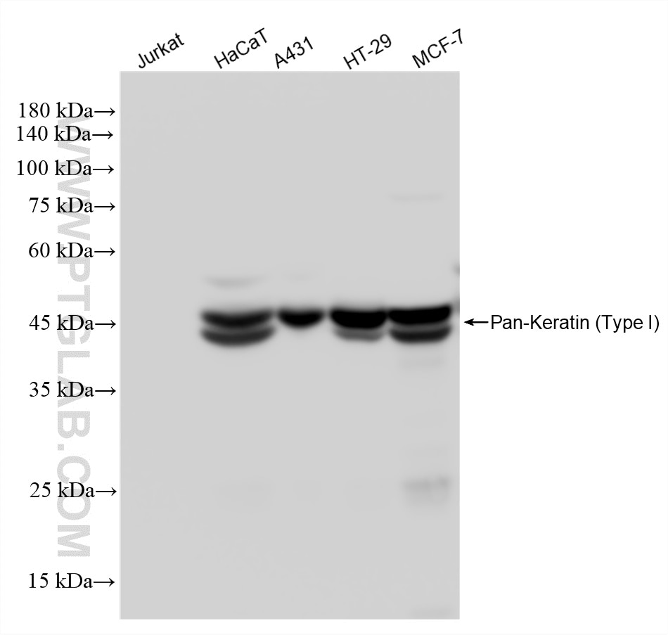 Western Blot (WB) analysis of various lysates using Pan-Keratin (Type I) Recombinant monoclonal antibo (86238-5-RR)