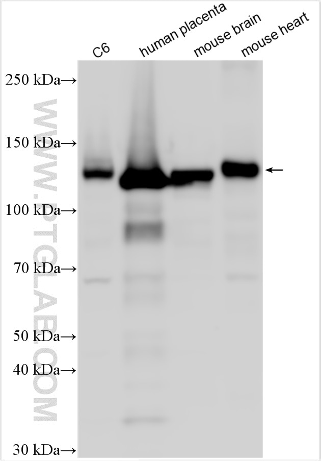 Western Blot (WB) analysis of various lysates using Pan-cadherin Polyclonal antibody (31313-1-AP)