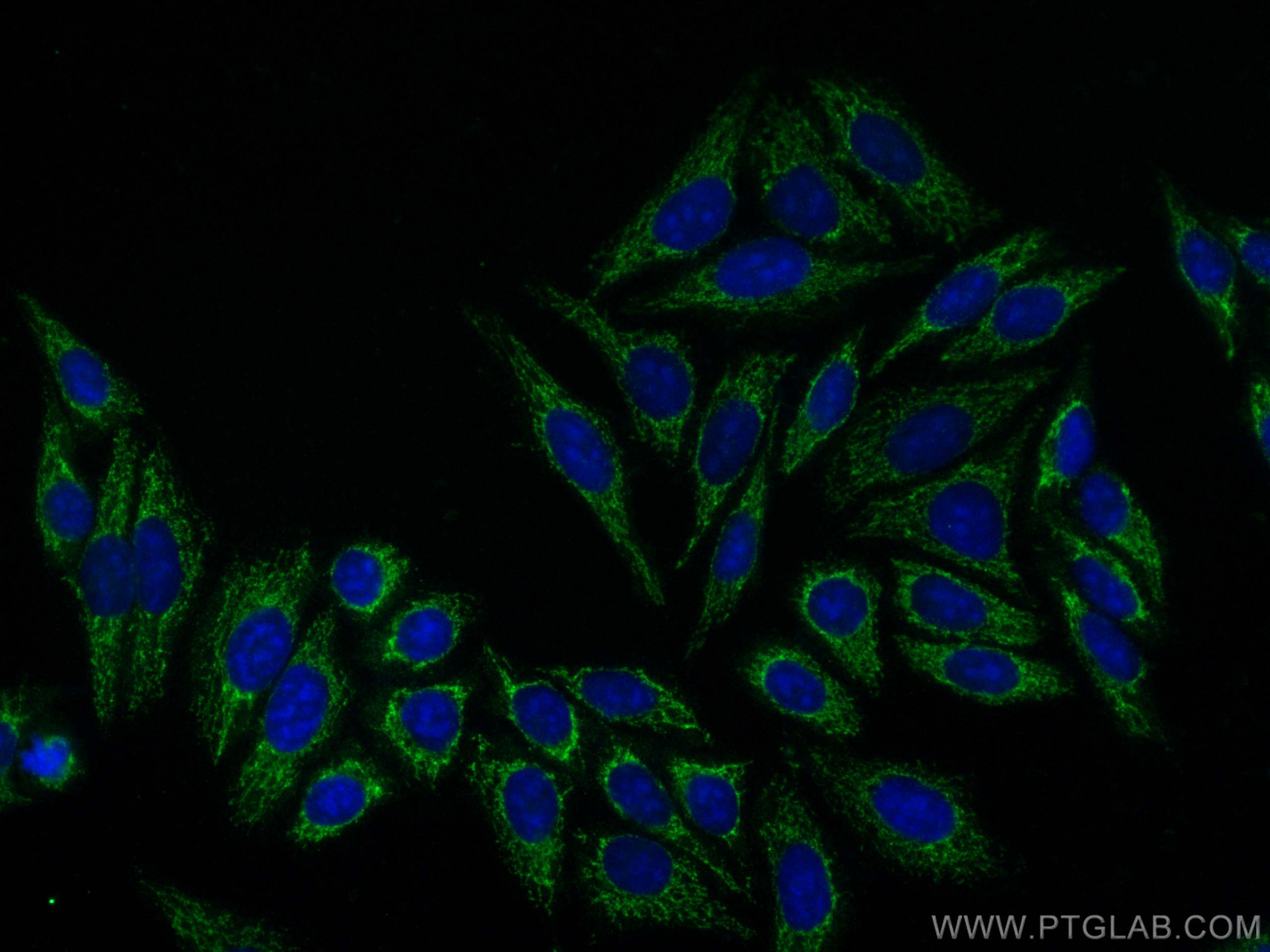 Pancreatic Polypeptide