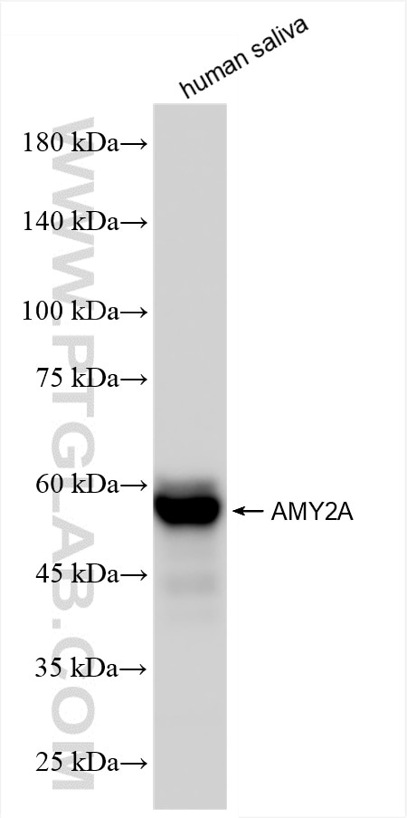 Western Blot (WB) analysis of human saliva using Pancreatic alpha-amylase Recombinant antibody (86243-1-RR)