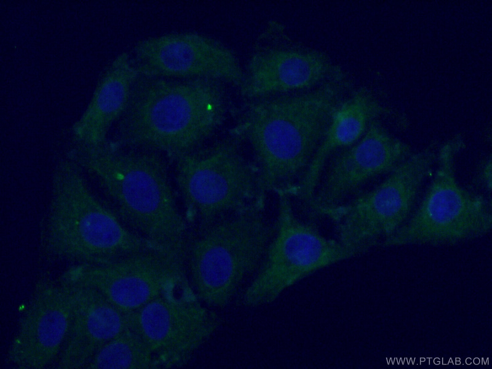 Immunofluorescence (IF) / fluorescent staining of SH-SY5Y cells using PARK2/Parkin Monoclonal antibody (66674-1-Ig)