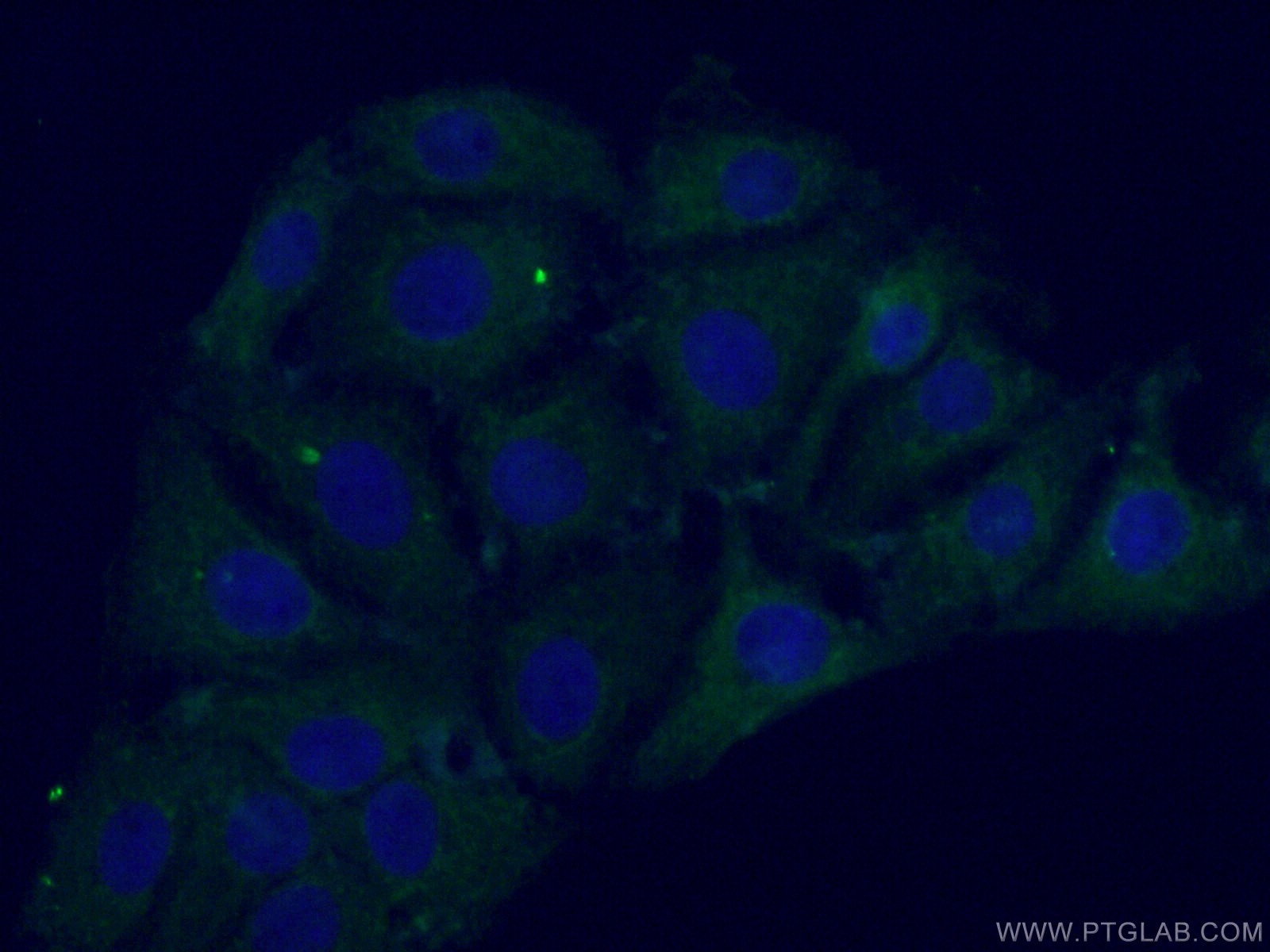 IF Staining of SH-SY5Y using 66674-1-Ig