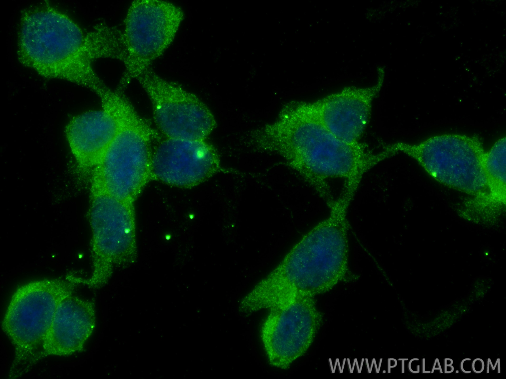IF Staining of SH-SY5Y using 66674-1-Ig Immunofluorescence (IF) / fluorescent staining of SH-SY5Y cells using PARK2/Parkin Monoclonal antibody (66674-1-Ig)