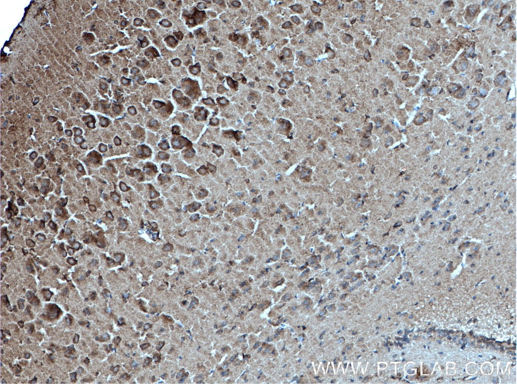 Immunohistochemistry (IHC) staining of mouse brain tissue using PARK2/Parkin Monoclonal antibody (66674-1-Ig)