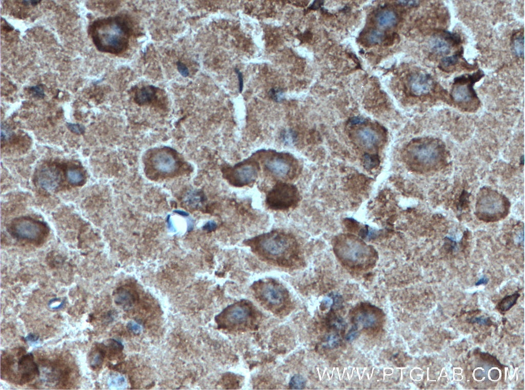 Immunohistochemistry (IHC) staining of mouse brain tissue using PARK2/Parkin Monoclonal antibody (66674-1-Ig)