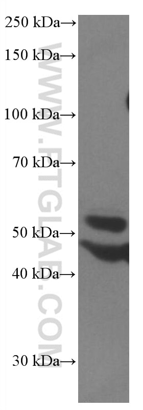Western Blot (WB) analysis of HEK-293 cells using PARK2/Parkin Monoclonal antibody (66674-1-Ig)