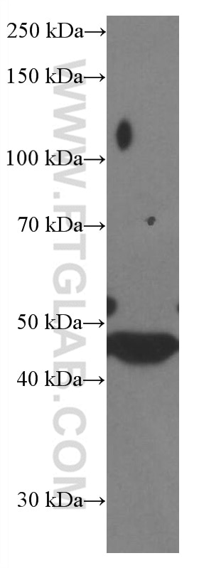 Western Blot (WB) analysis of SH-SY5Y cells using PARK2/Parkin Monoclonal antibody (66674-1-Ig)