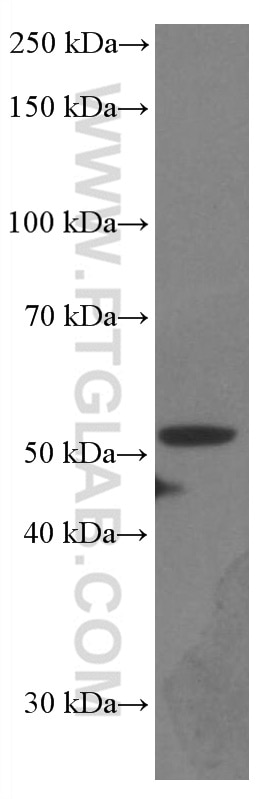 WB analysis of U-251 using 66674-1-Ig