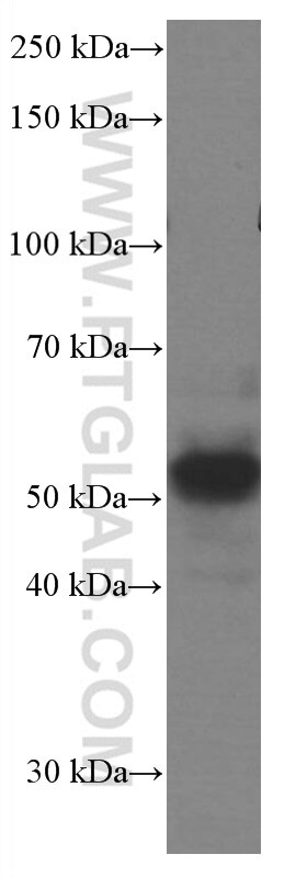 Western Blot (WB) analysis of mouse brain tissue using PARK2/Parkin Monoclonal antibody (66674-1-Ig)