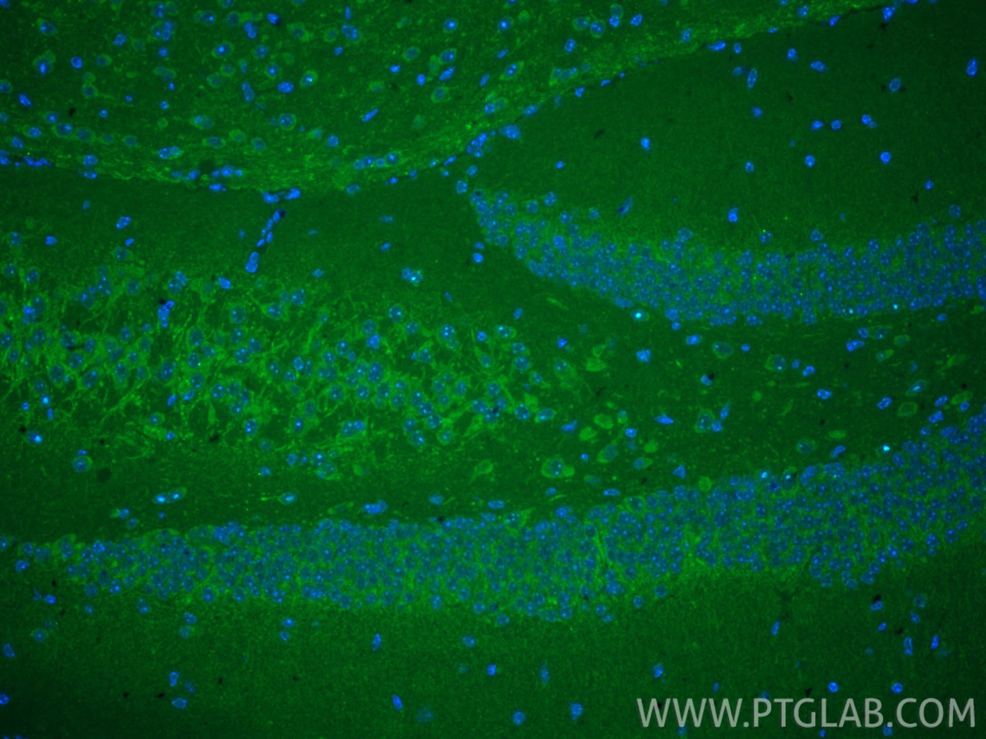 IF Staining of mouse brain using 66674-4-Ig Immunofluorescence (IF) / fluorescent staining of mouse brain tissue using PARK2/Parkin Monoclonal antibody (66674-4-Ig)