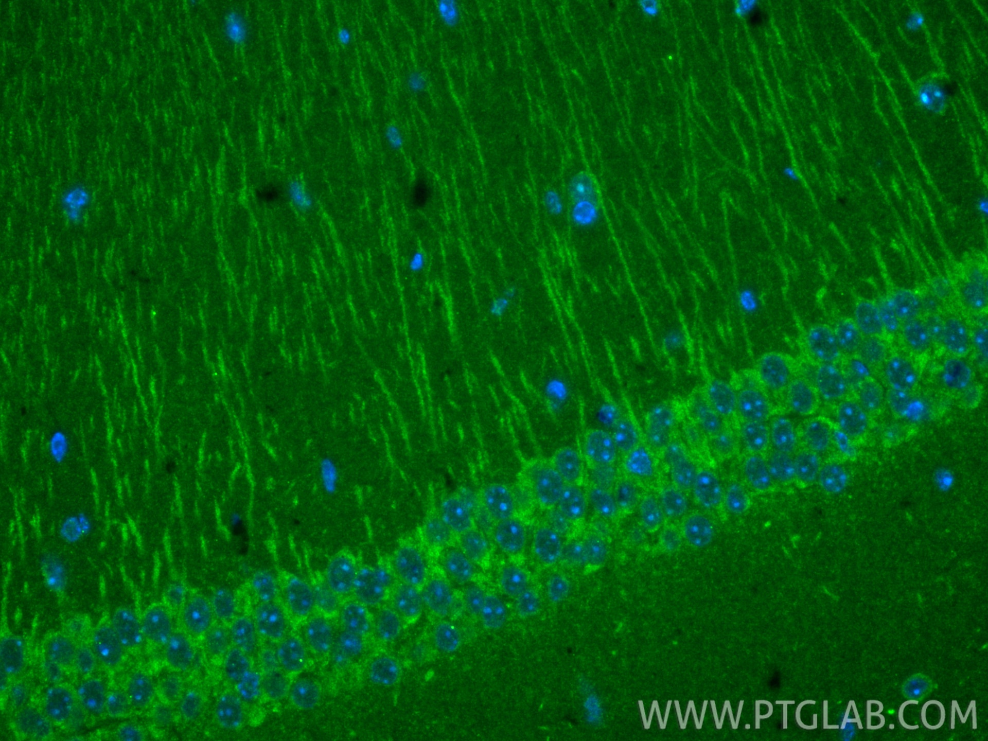 Immunofluorescence (IF) / fluorescent staining of mouse brain tissue using PARK2/Parkin Monoclonal antibody (66674-4-Ig)