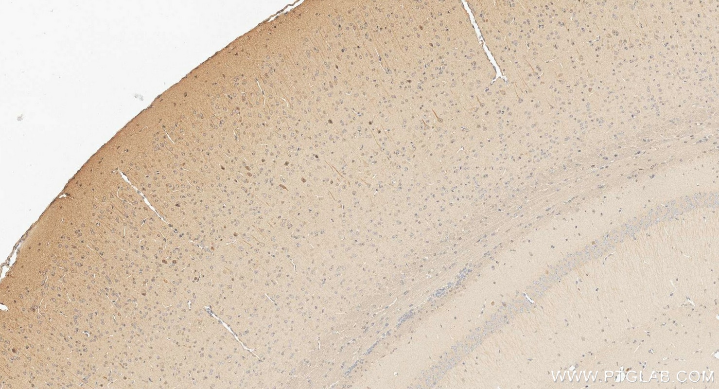IHC staining of mouse brain using 66674-4-Ig Immunohistochemistry (IHC) staining of mouse brain tissue using PARK2/Parkin Monoclonal antibody (66674-4-Ig)