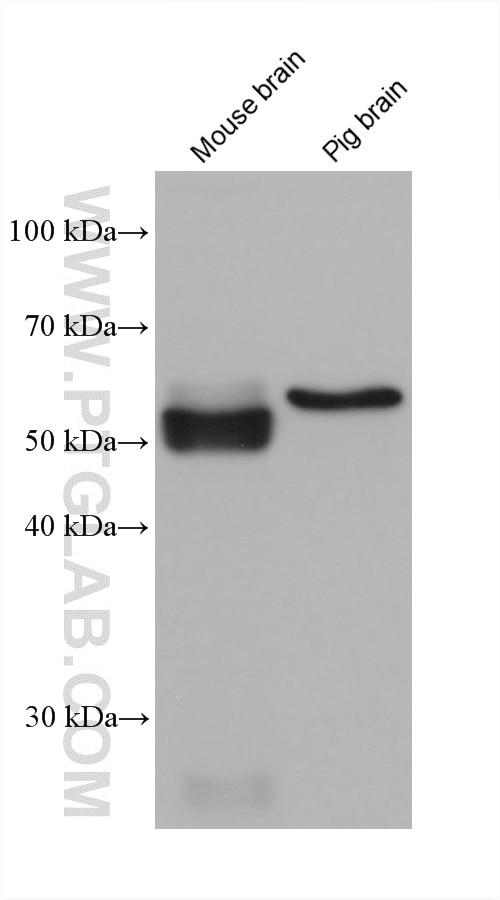 WB analysis using 66674-4-Ig Western Blot (WB) analysis of various lysates using PARK2/Parkin Monoclonal antibody (66674-4-Ig)