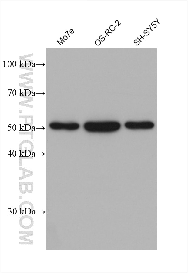 WB analysis using 66674-4-Ig Western Blot (WB) analysis of various lysates using PARK2/Parkin Monoclonal antibody (66674-4-Ig)