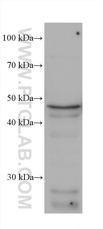 WB analysis of rat brain using 66674-4-Ig Western Blot (WB) analysis of rat brain tissue using PARK2/Parkin Monoclonal antibody (66674-4-Ig)