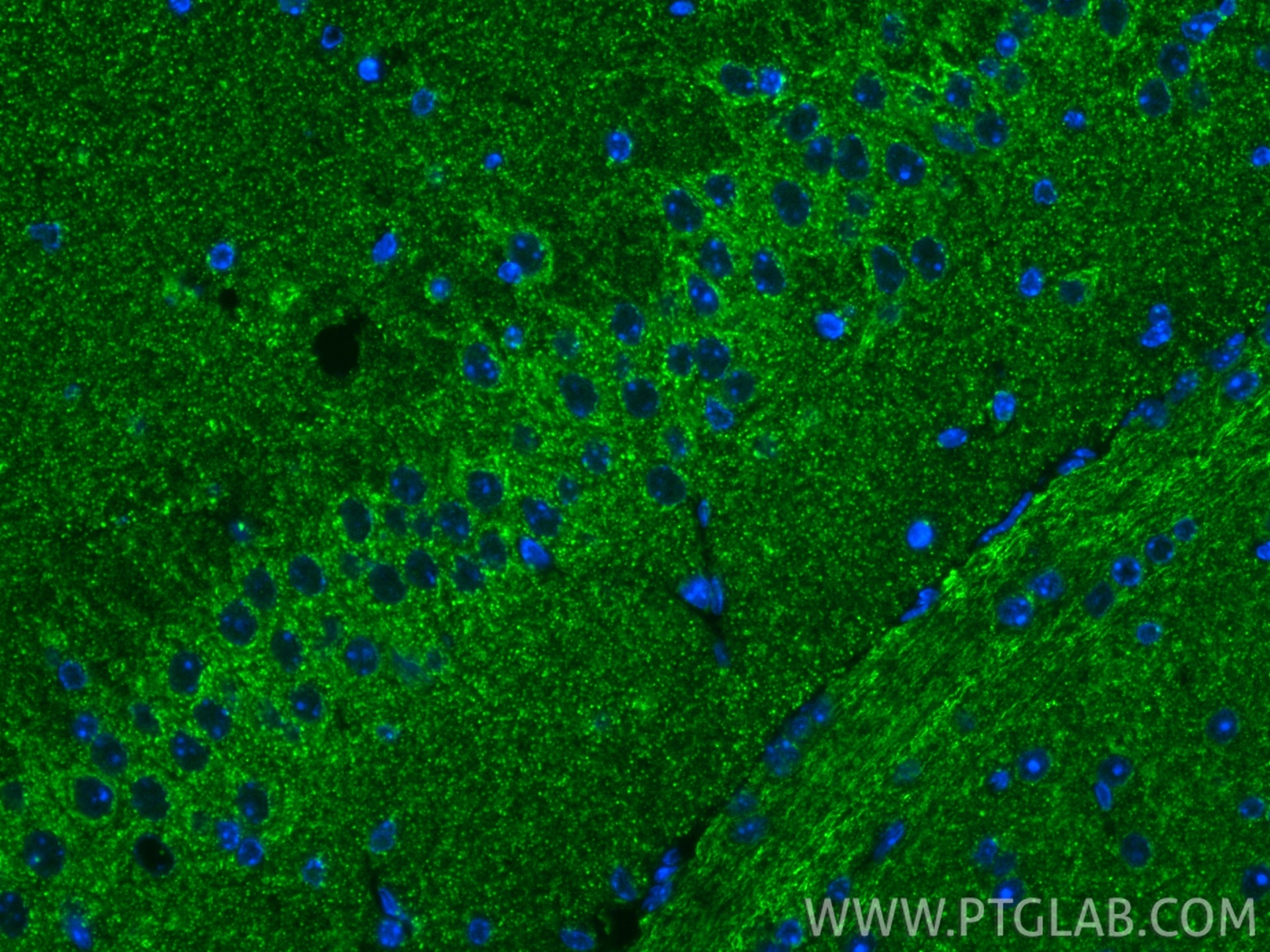 Immunofluorescence (IF) / fluorescent staining of mouse brain tissue using PARK2/Parkin Recombinant monoclonal antibody (83224-5-RR)