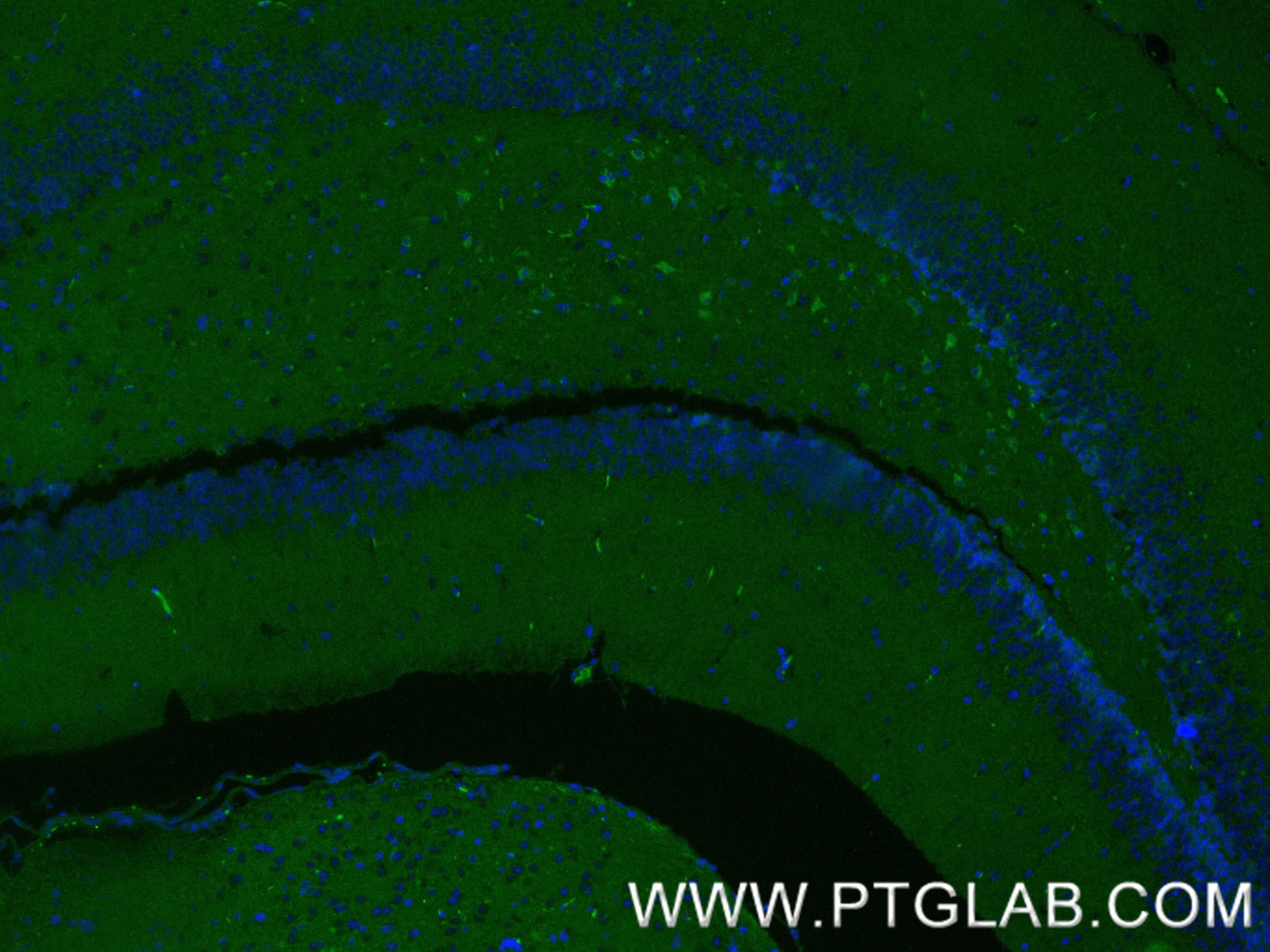 Immunofluorescence (IF) / fluorescent staining of mouse brain tissue using PARK2/Parkin Recombinant monoclonal antibody (83224-5-RR)