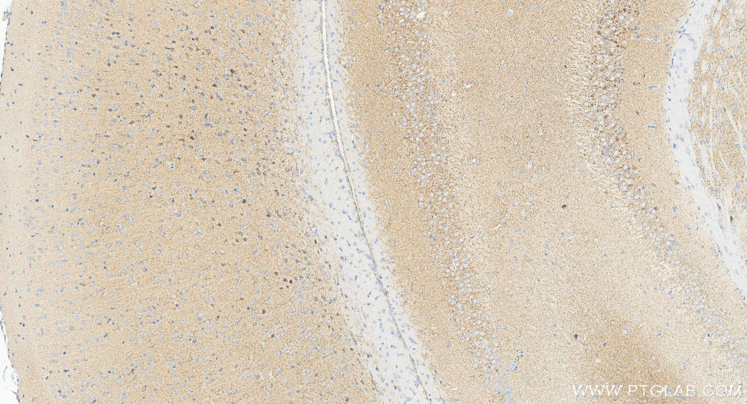 Immunohistochemistry (IHC) staining of mouse brain tissue using PARK2/Parkin Recombinant monoclonal antibody (83224-5-RR)