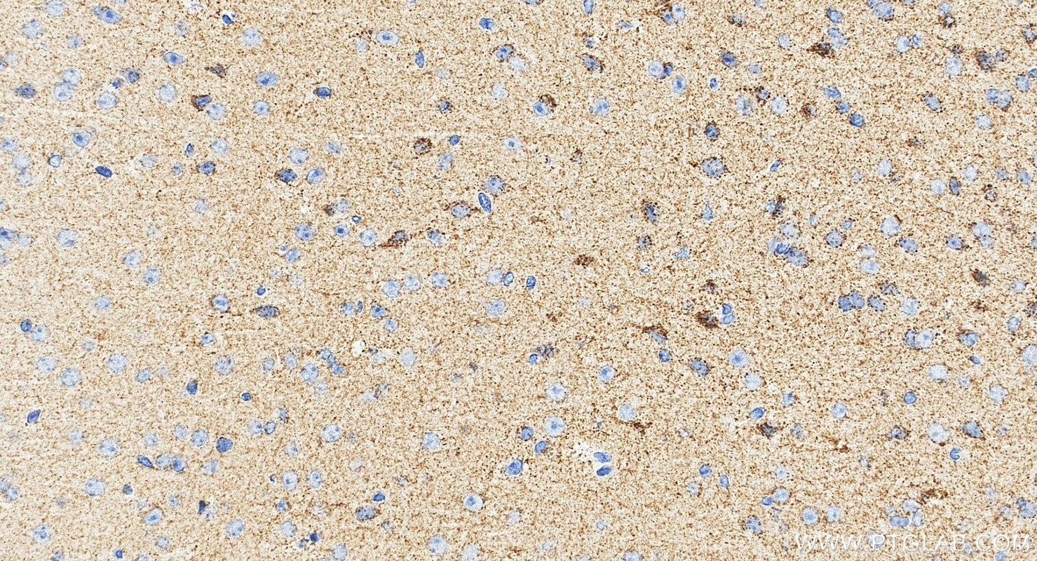 Immunohistochemistry (IHC) staining of mouse brain tissue using PARK2/Parkin Recombinant monoclonal antibody (83224-5-RR)