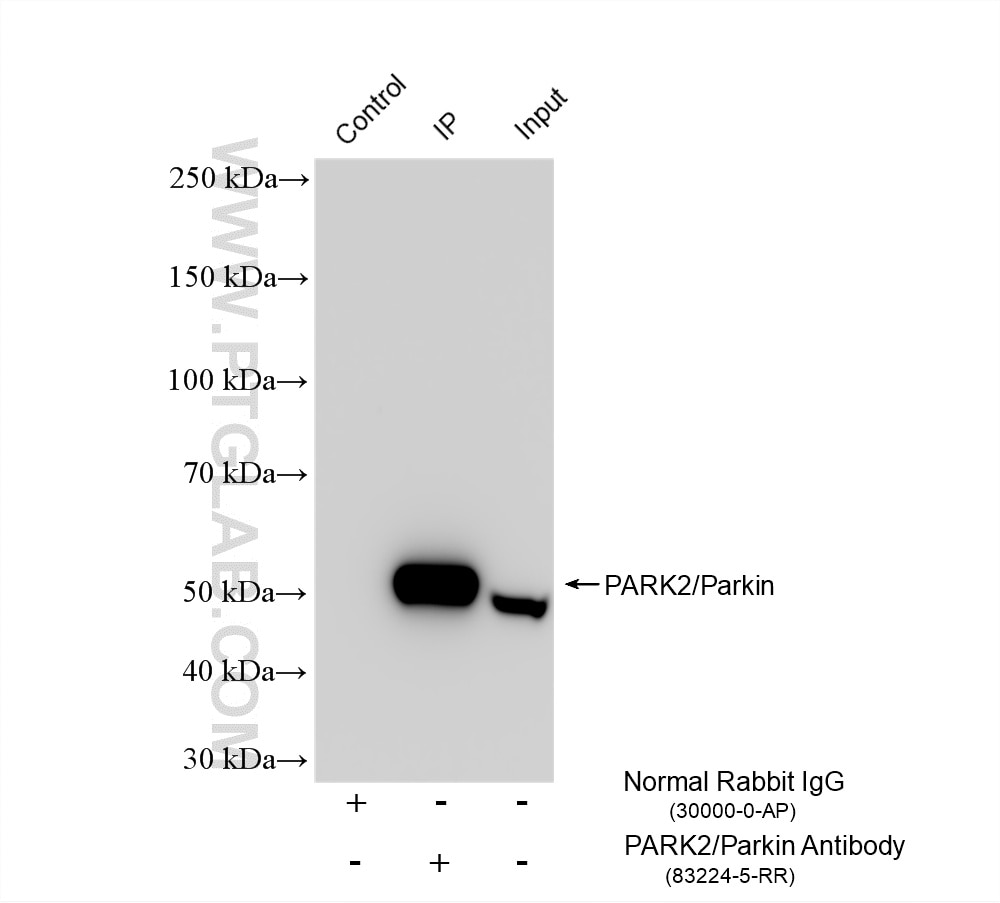 Immunoprecipitation (IP) experiment of mouse brain tissue using PARK2/Parkin Recombinant monoclonal antibody (83224-5-RR)