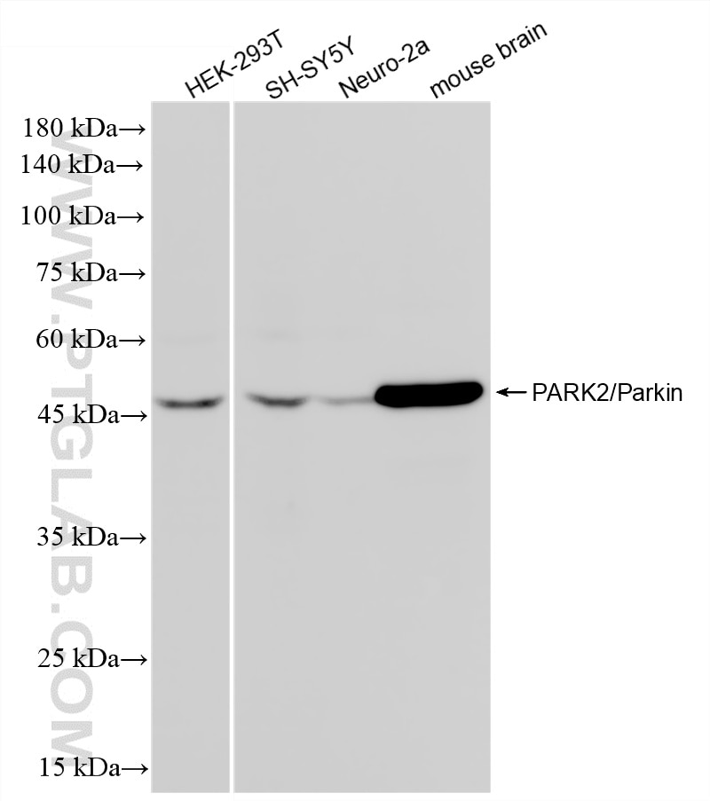 Western Blot (WB) analysis of various lysates using PARK2/Parkin Recombinant monoclonal antibody (83224-5-RR)