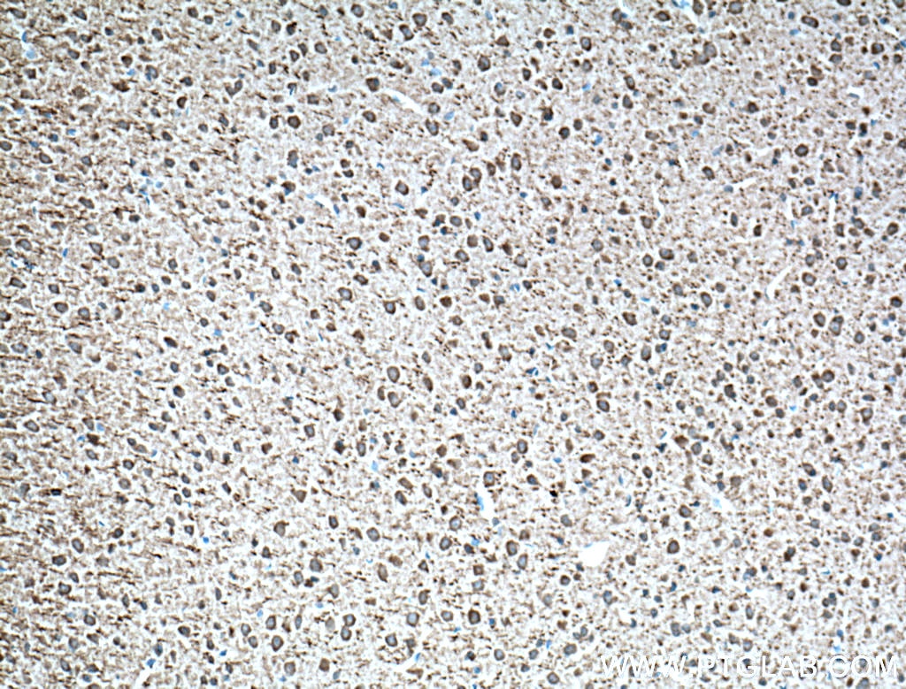 Immunohistochemistry (IHC) staining of mouse brain tissue using Parvalbumin Polyclonal antibody (26521-1-AP)