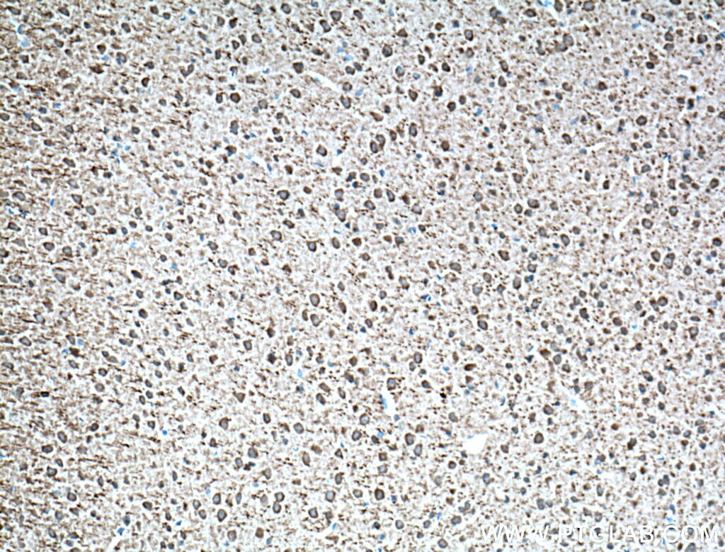 Immunohistochemistry (IHC) staining of mouse brain tissue using Parvalbumin Polyclonal antibody (26521-1-AP)