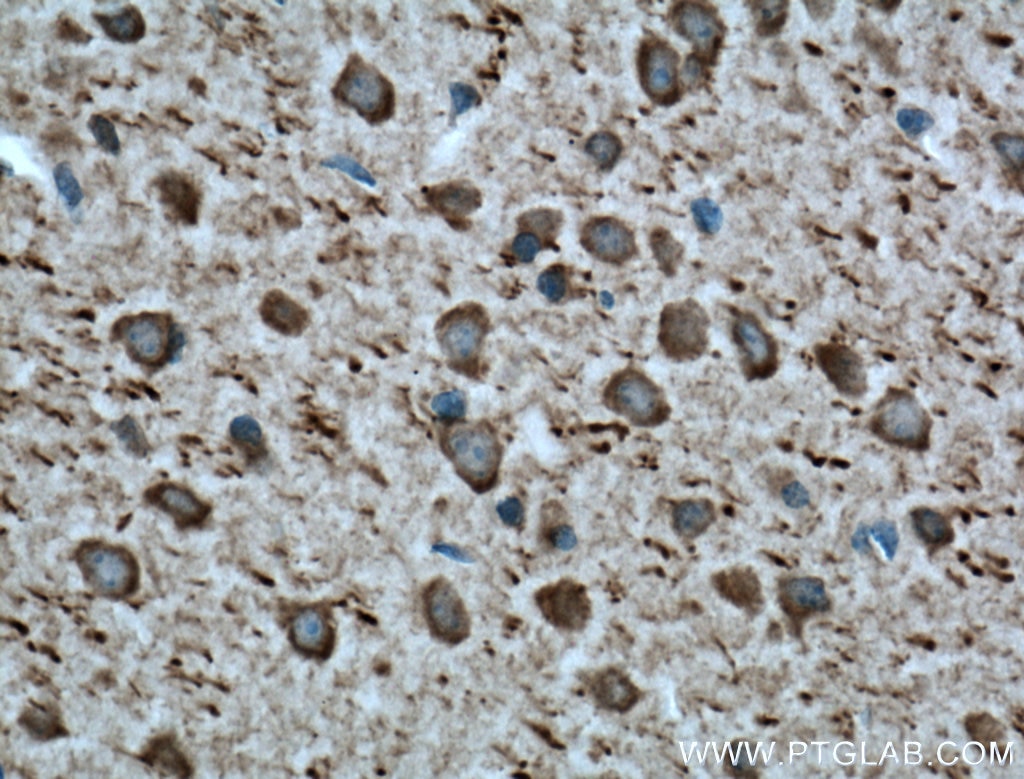 Immunohistochemistry (IHC) staining of mouse brain tissue using Parvalbumin Polyclonal antibody (26521-1-AP)