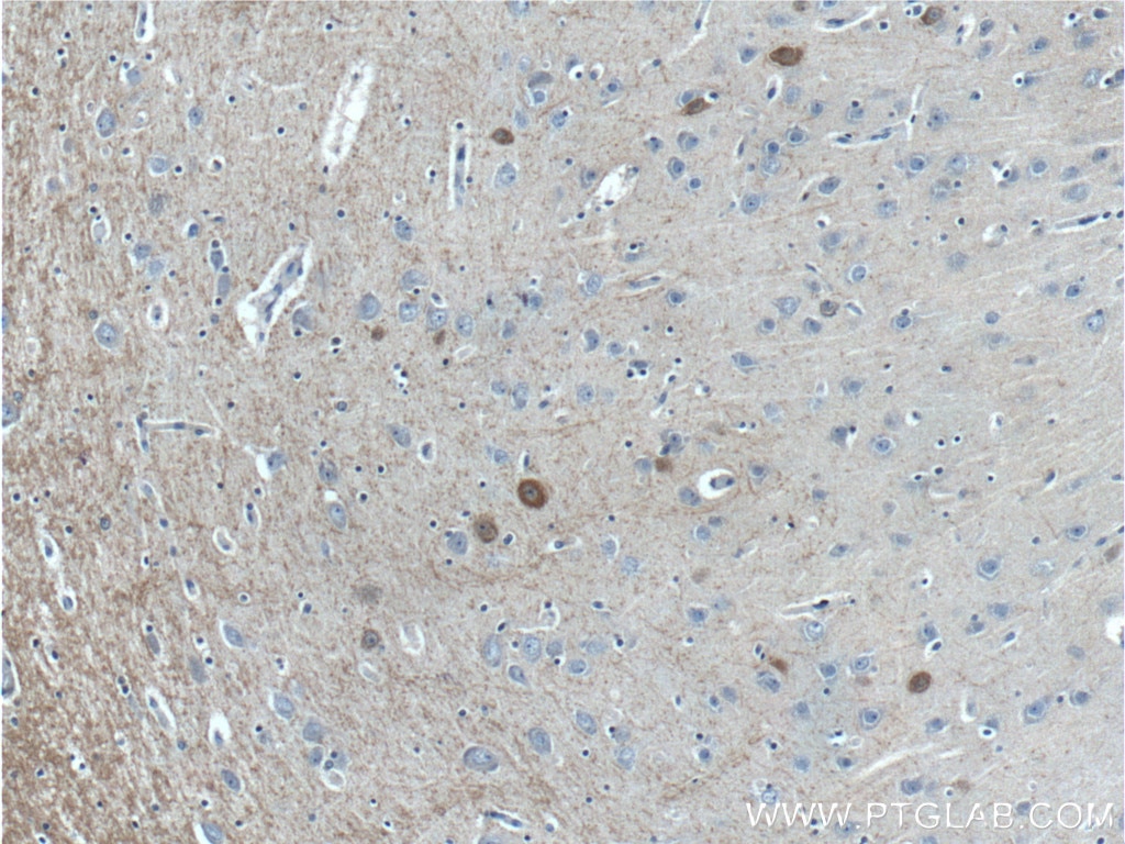 IHC staining of human brain using 26521-1-AP