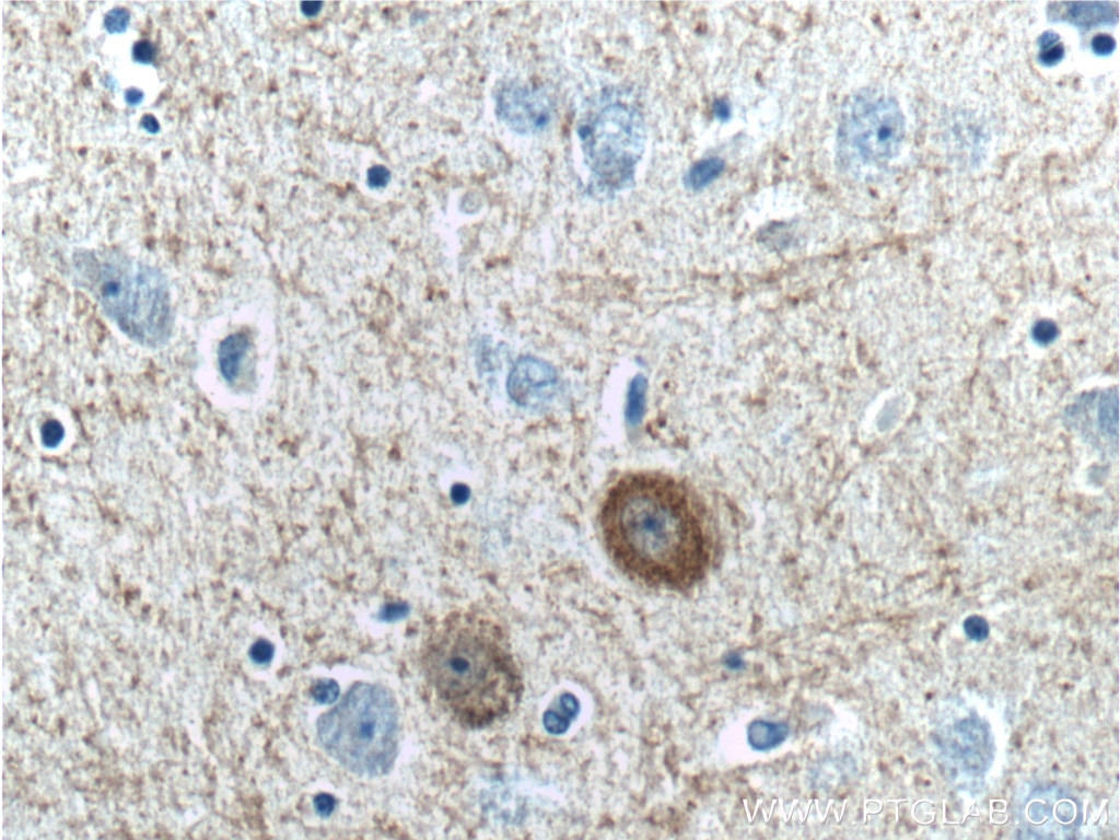 Immunohistochemistry (IHC) staining of human brain tissue using Parvalbumin Polyclonal antibody (26521-1-AP)