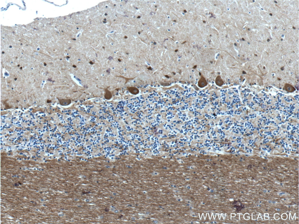 IHC staining of human cerebellum using 26521-1-AP