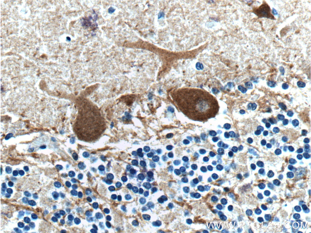Immunohistochemistry (IHC) staining of human cerebellum tissue using Parvalbumin Polyclonal antibody (26521-1-AP)