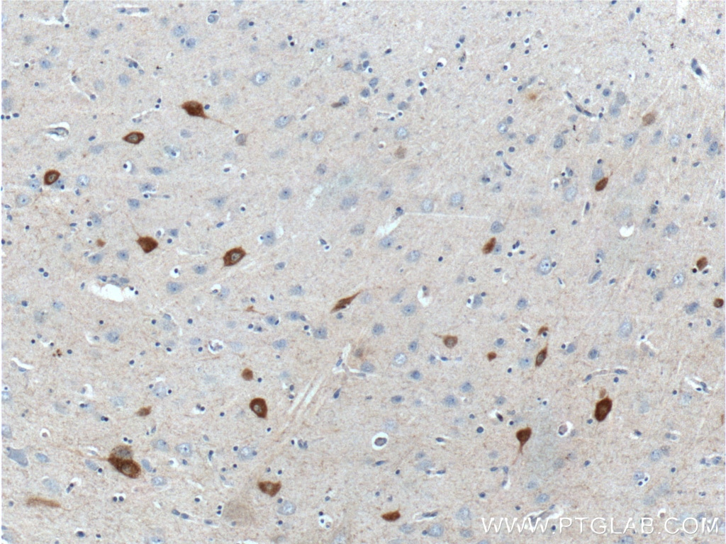 IHC staining of human brain using 26521-1-AP