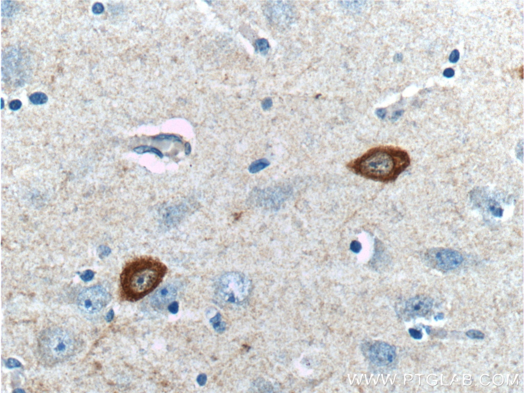 Immunohistochemistry (IHC) staining of human brain tissue using Parvalbumin Polyclonal antibody (26521-1-AP)