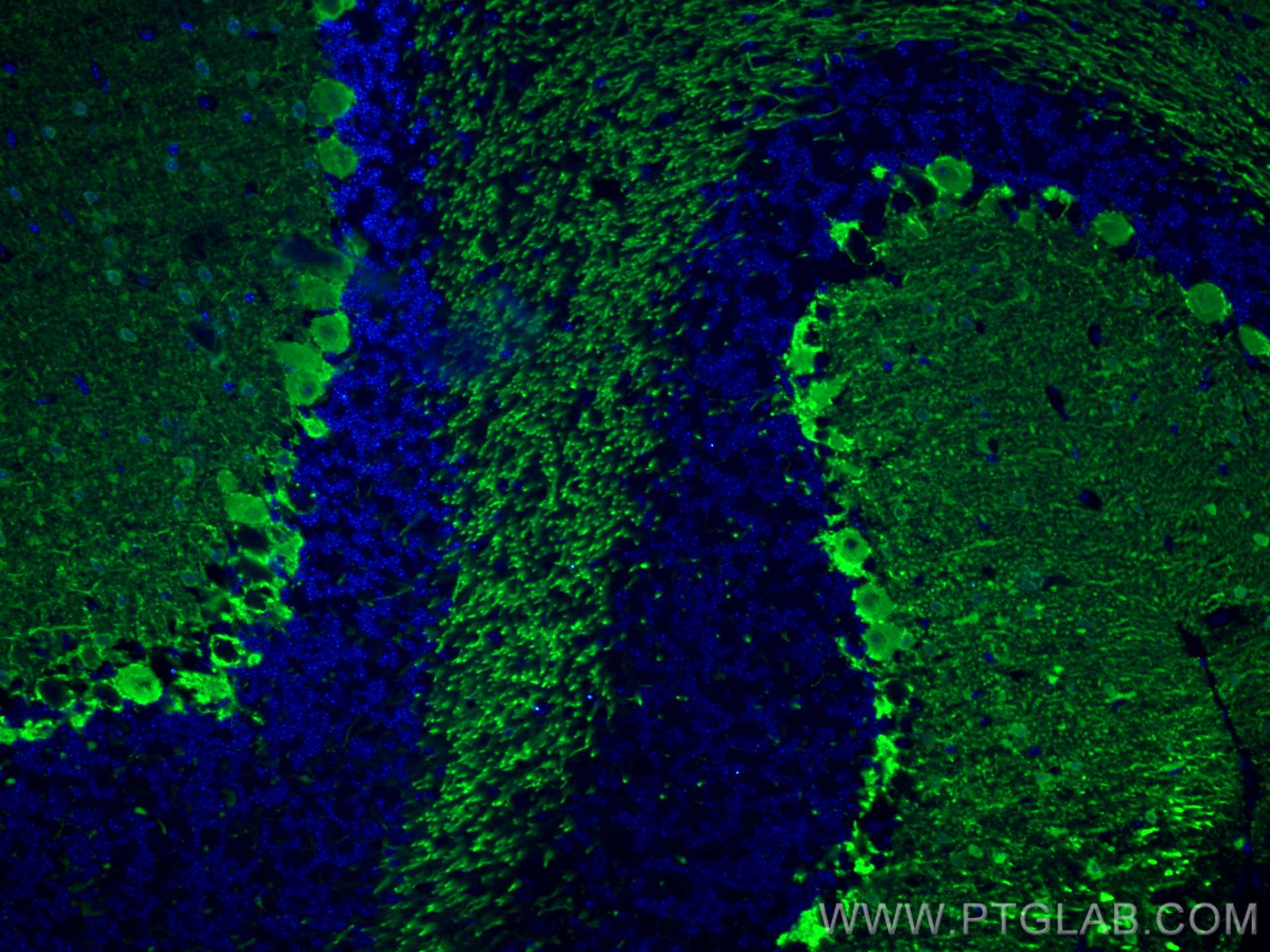 Immunofluorescence (IF) / fluorescent staining of mouse cerebellum tissue using Parvalbumin Polyclonal antibody (29312-1-AP)