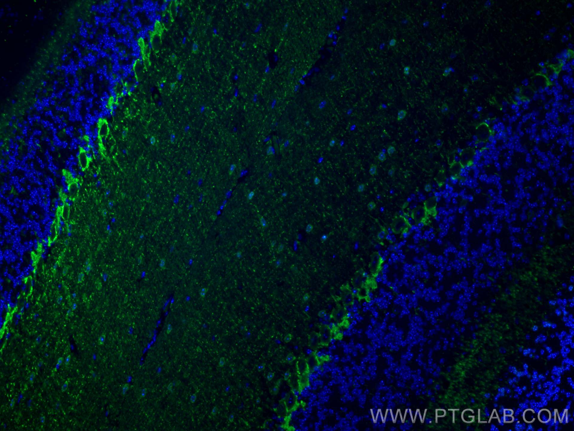 Immunofluorescence (IF) / fluorescent staining of mouse cerebellum tissue using Parvalbumin Polyclonal antibody (29312-1-AP)