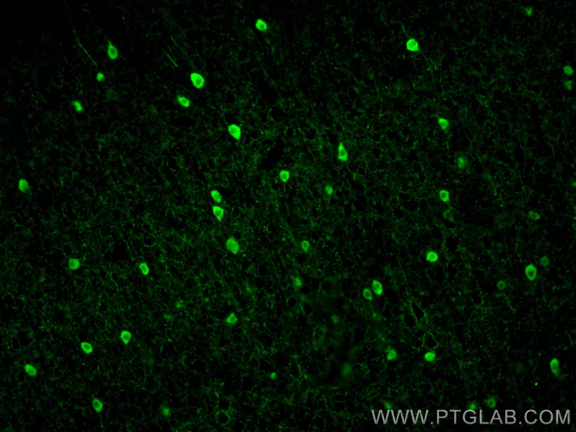 IF Staining of mouse brain using 29312-1-AP