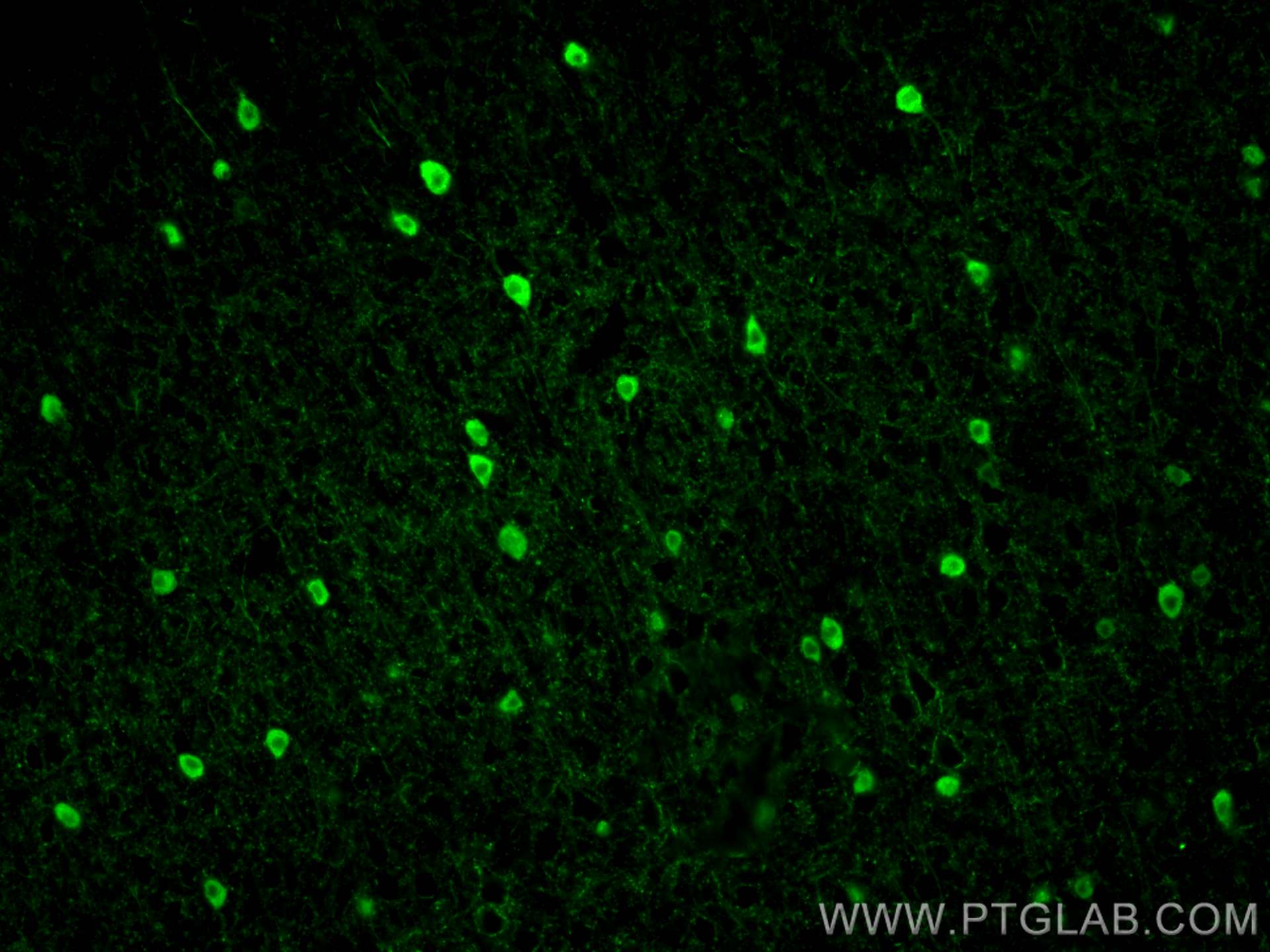 Immunofluorescence (IF) / fluorescent staining of mouse brain tissue using Parvalbumin Polyclonal antibody (29312-1-AP)