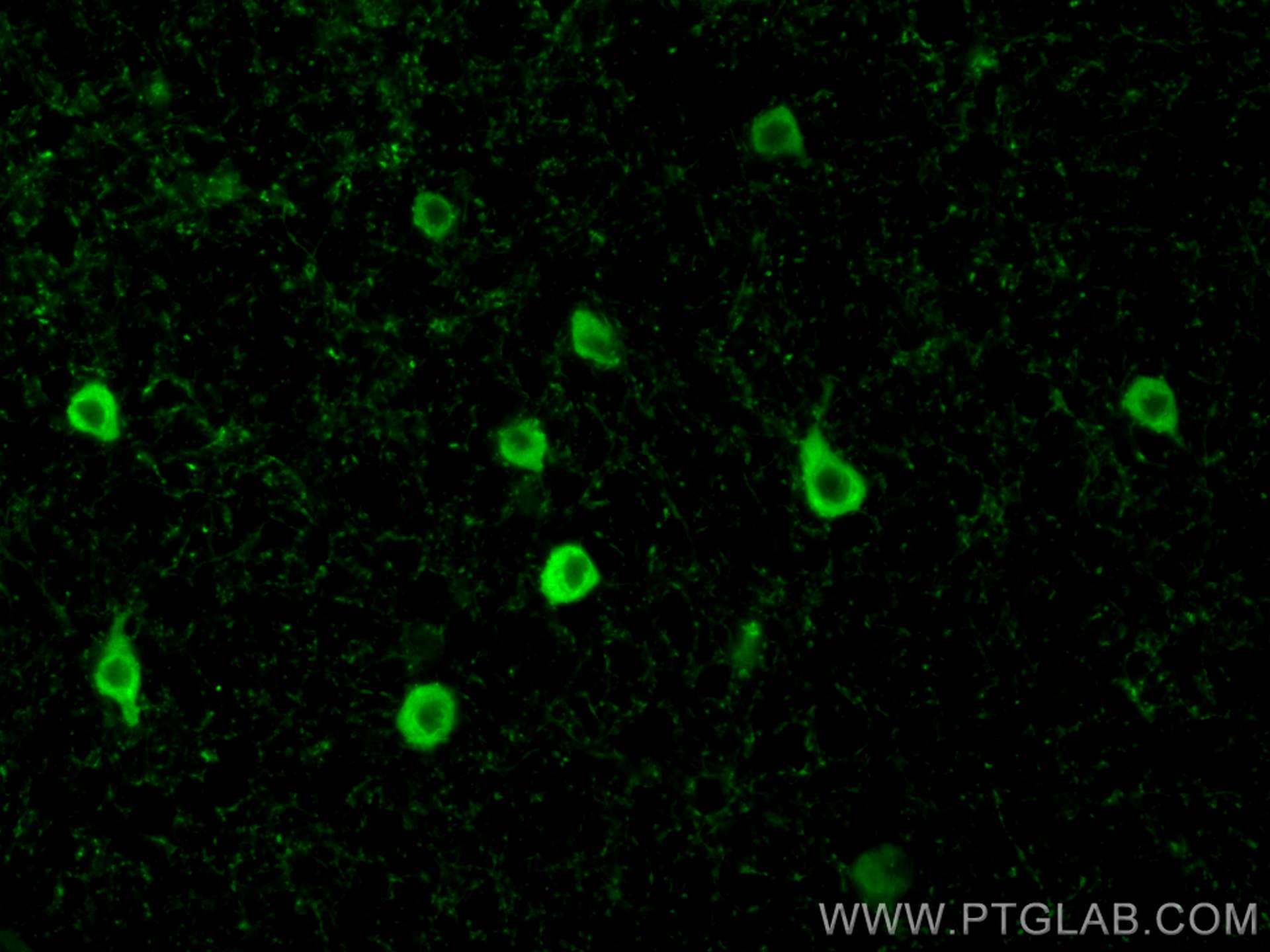 Immunofluorescence (IF) / fluorescent staining of mouse brain tissue using Parvalbumin Polyclonal antibody (29312-1-AP)