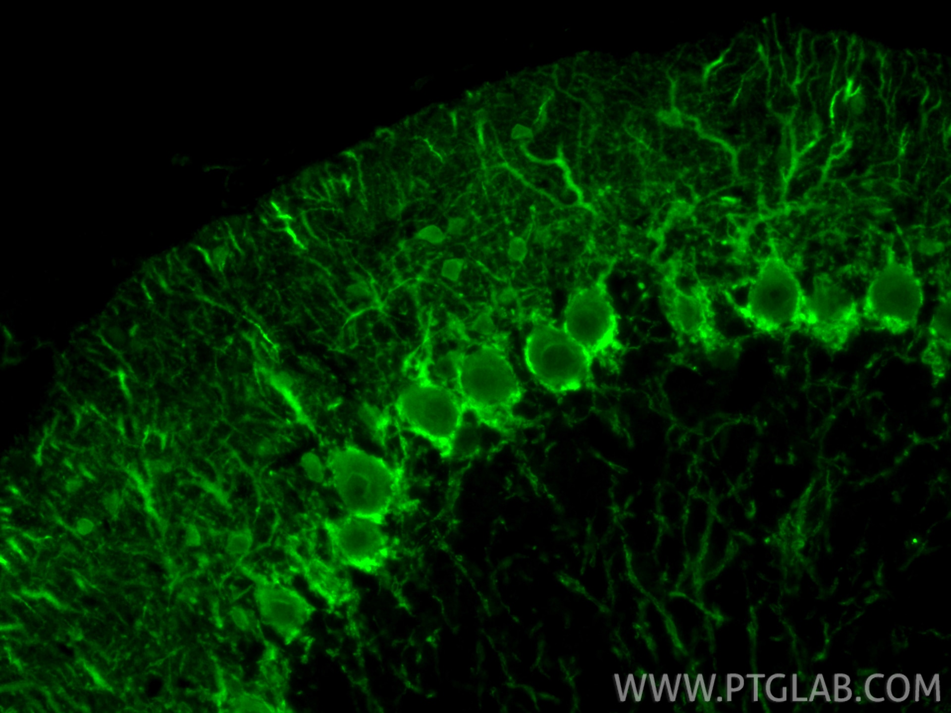 Immunofluorescence (IF) / fluorescent staining of mouse cerebellum tissue using Parvalbumin Polyclonal antibody (29312-1-AP)