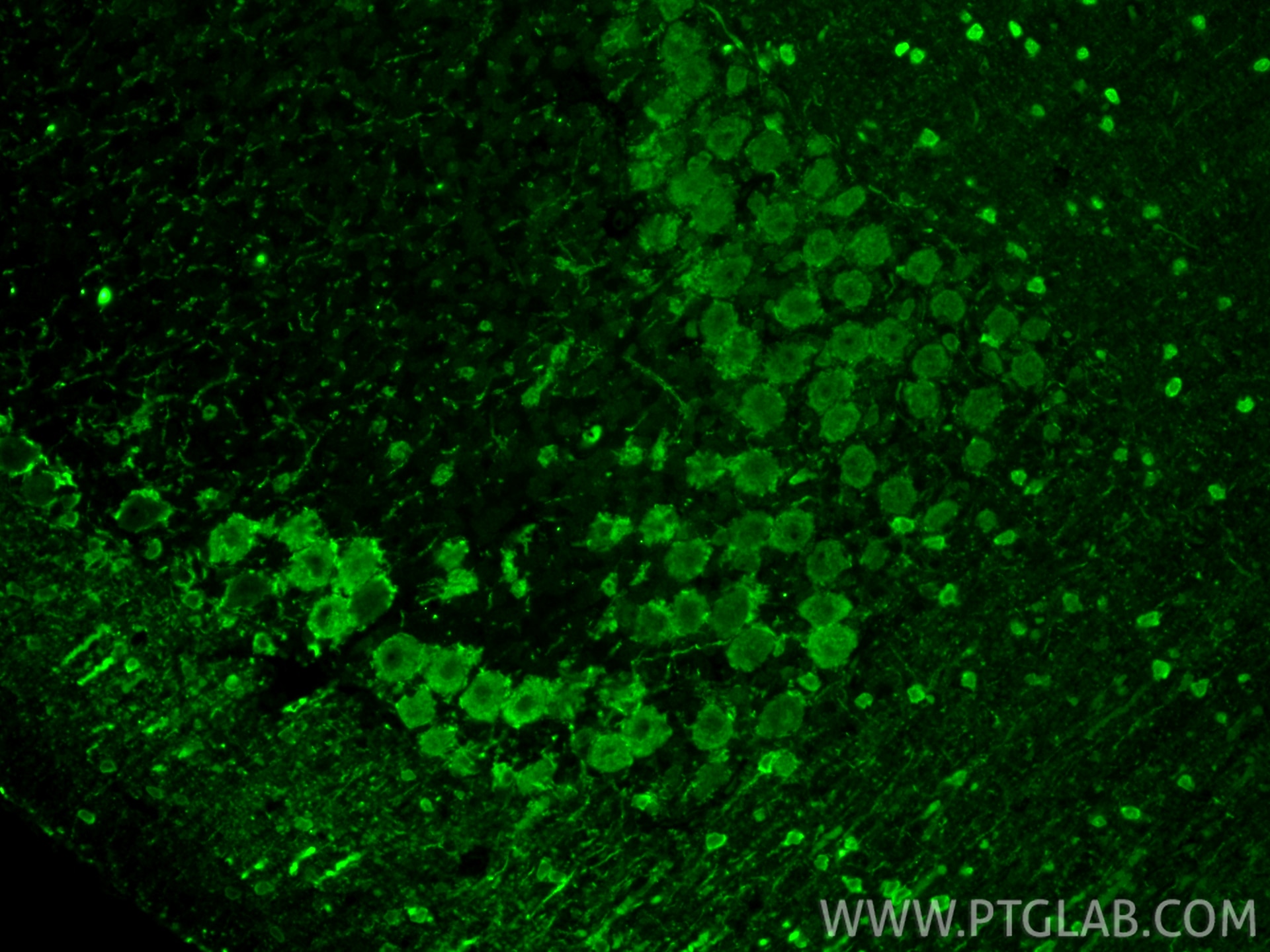 Immunofluorescence (IF) / fluorescent staining of rat cerebellum tissue using Parvalbumin Polyclonal antibody (29312-1-AP)