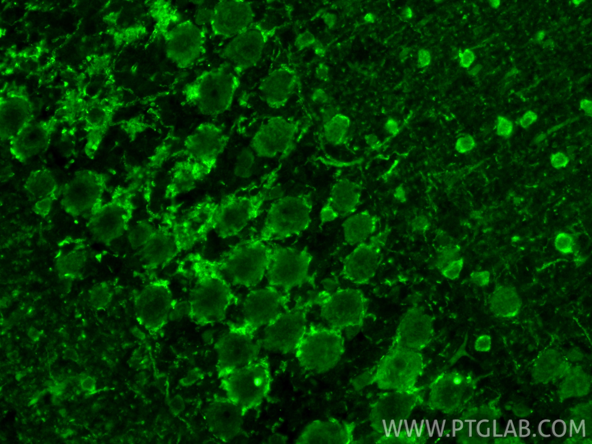Immunofluorescence (IF) / fluorescent staining of rat cerebellum tissue using Parvalbumin Polyclonal antibody (29312-1-AP)