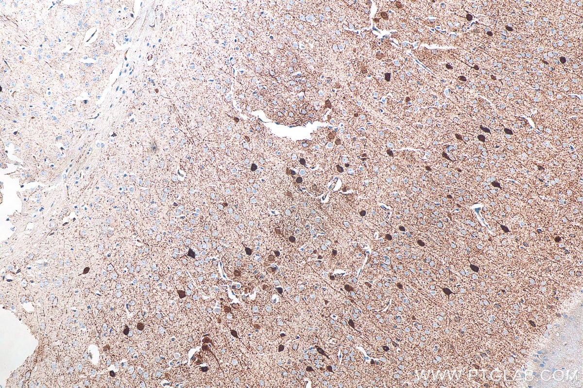 IHC staining of mouse brain using 29312-1-AP