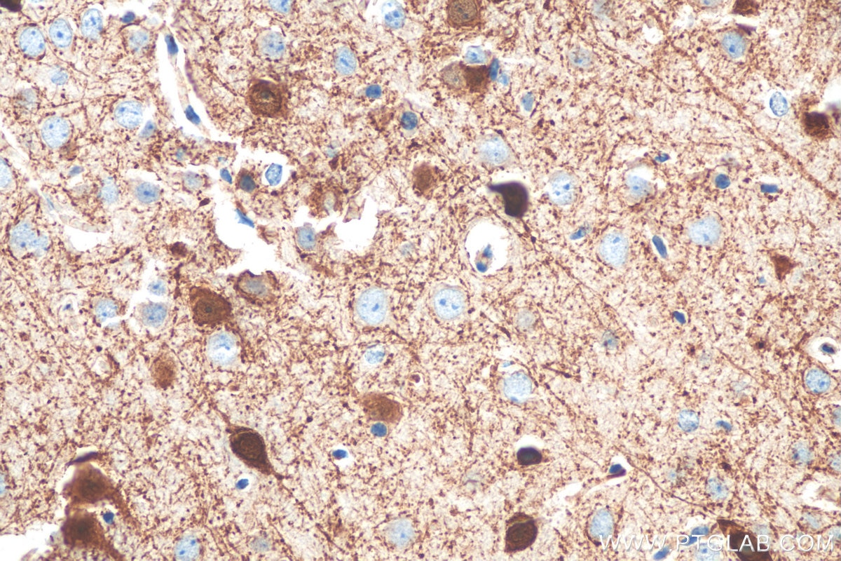 Immunohistochemistry (IHC) staining of mouse brain tissue using Parvalbumin Polyclonal antibody (29312-1-AP)