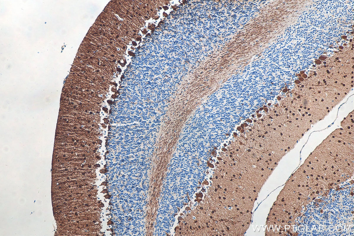 Immunohistochemistry (IHC) staining of mouse cerebellum tissue using Parvalbumin Polyclonal antibody (29312-1-AP)