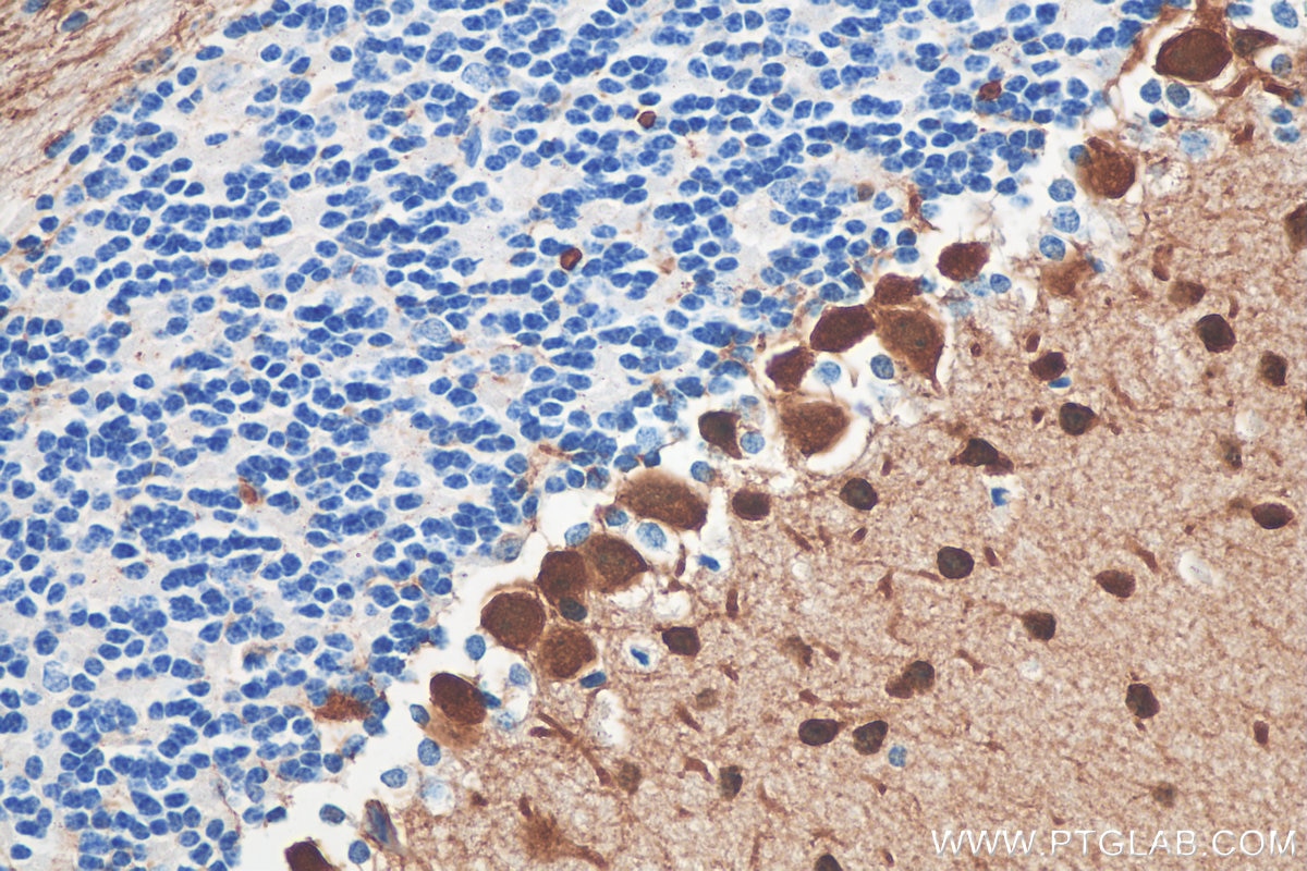 Immunohistochemistry (IHC) staining of mouse cerebellum tissue using Parvalbumin Polyclonal antibody (29312-1-AP)