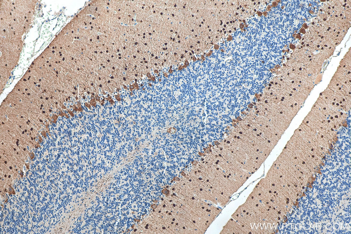 Immunohistochemistry (IHC) staining of rat cerebellum tissue using Parvalbumin Polyclonal antibody (29312-1-AP)