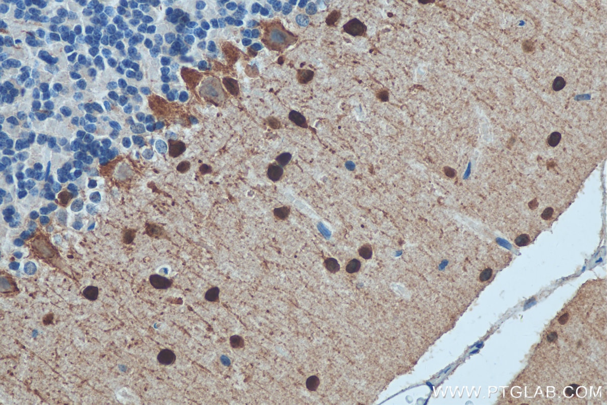 Immunohistochemistry (IHC) staining of rat cerebellum tissue using Parvalbumin Polyclonal antibody (29312-1-AP)