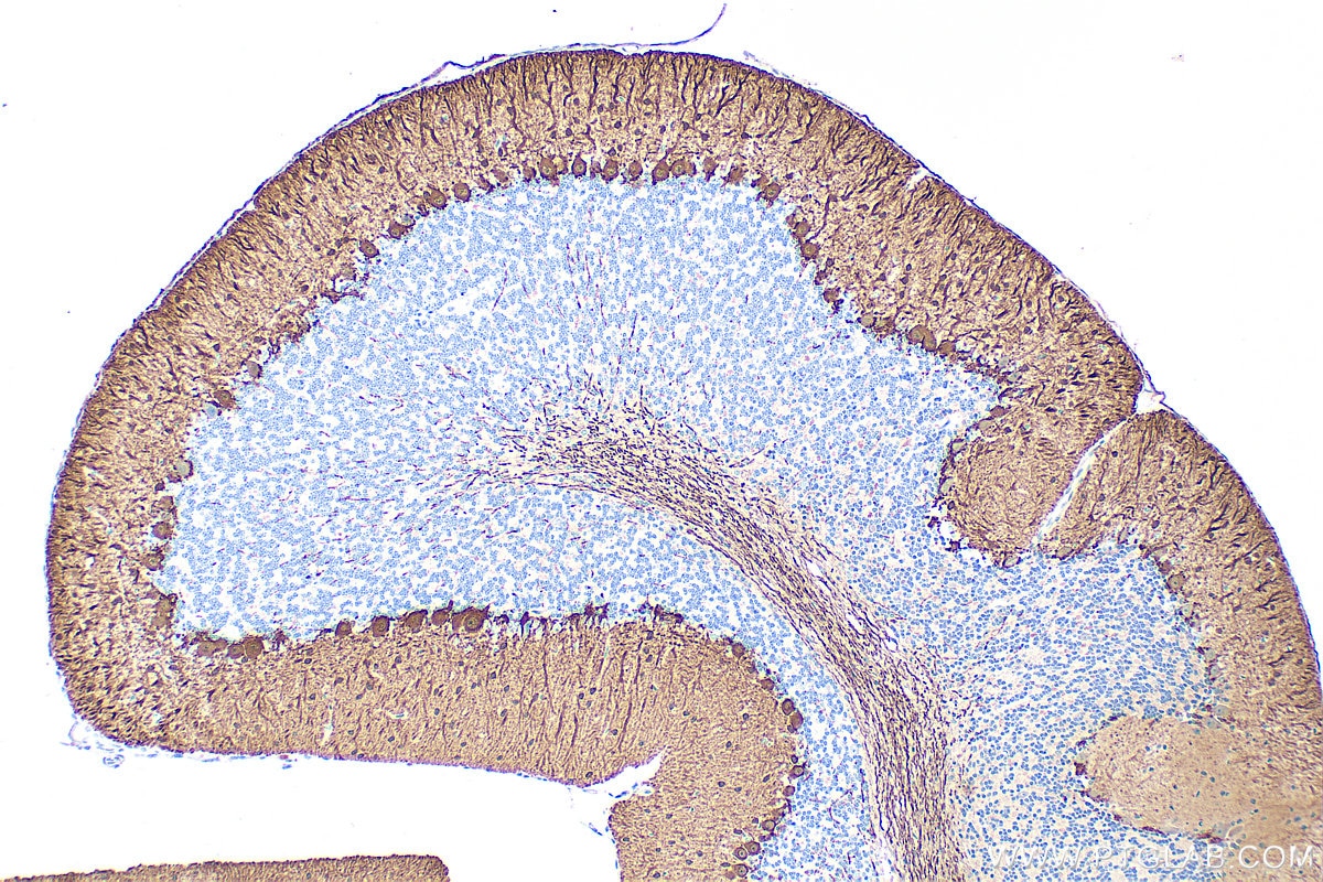 Immunohistochemistry (IHC) staining of mouse cerebellum tissue using Parvalbumin Polyclonal antibody (29312-1-AP)